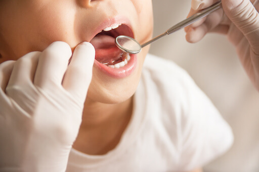 歯科検診を受ける子供